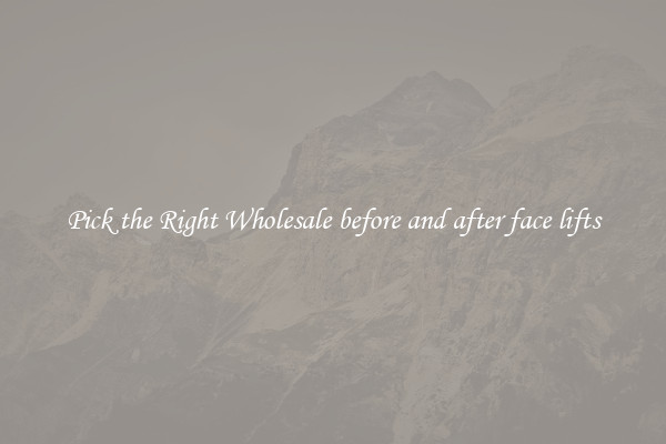 Pick the Right Wholesale before and after face lifts